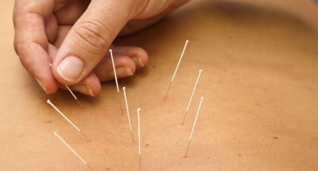 tratamiento de la artrosis acupuntura